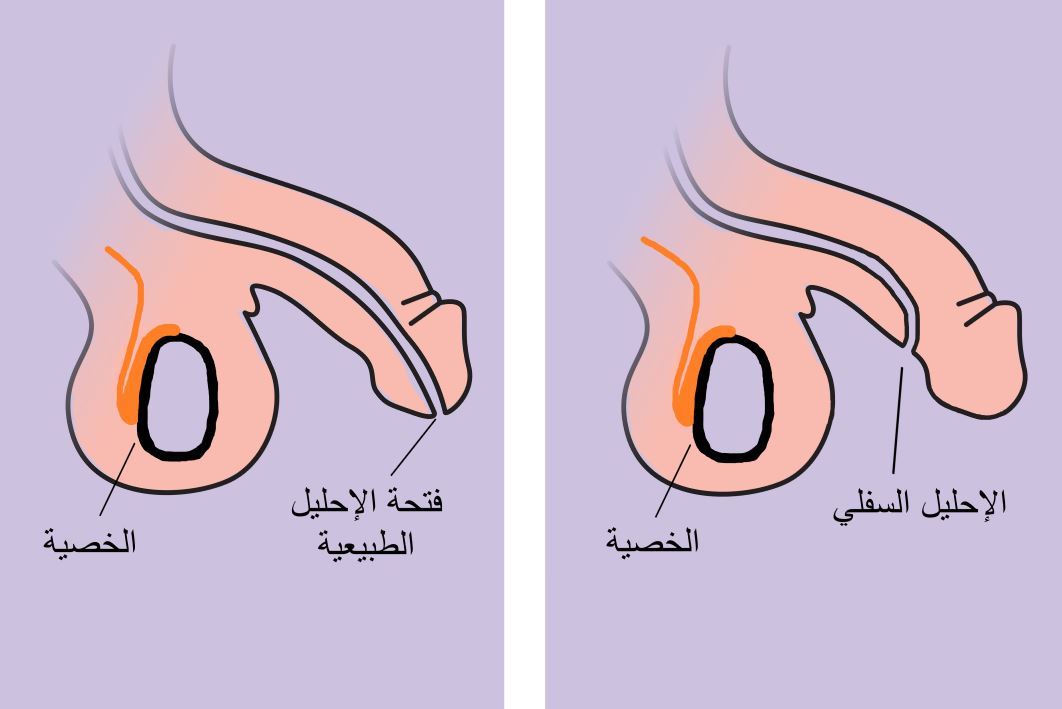 /تعديل الاحليل